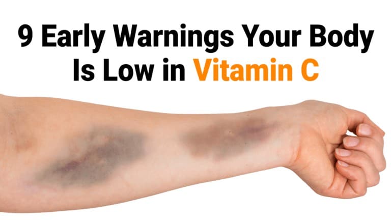 vitamin c