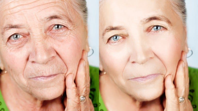 look younger naturally