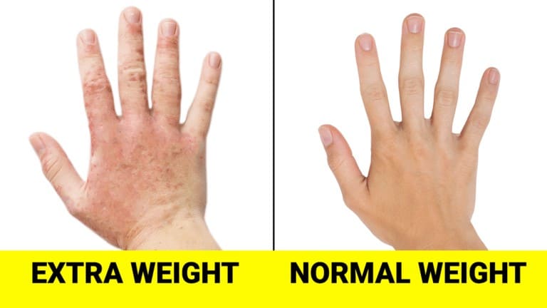 lose extra weight