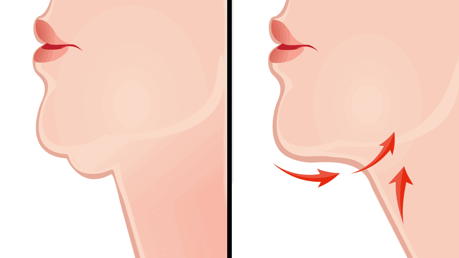 10 Ways to Lose a Double Chin