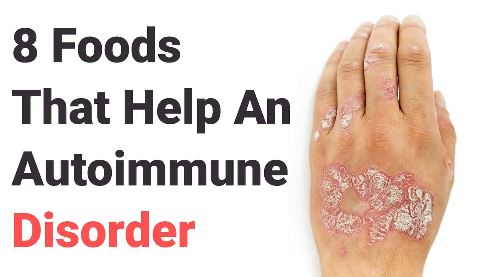8 Foods That Help An Autoimmune Disorder