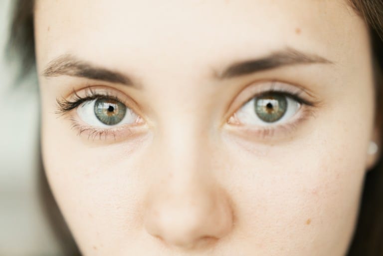 dark circles under eyes