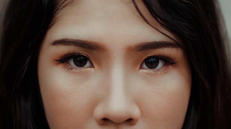 dark circles under eyes