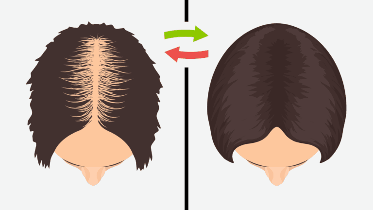 regrow hair