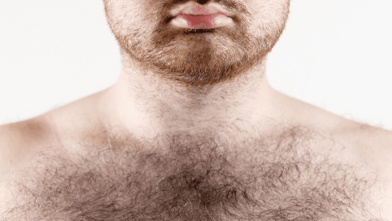 body hair