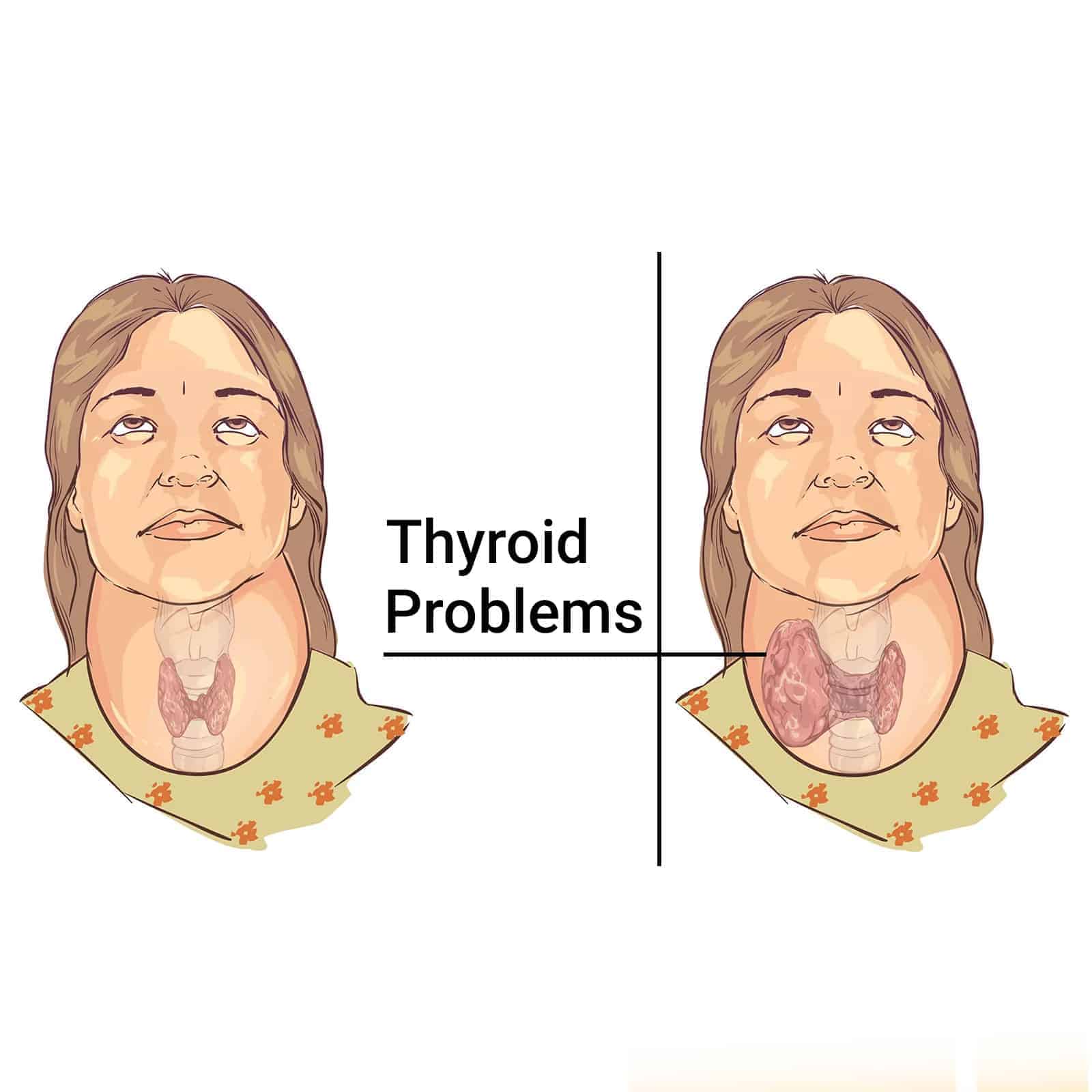 Science Explains 11 Foods That Heal Your Thyroid