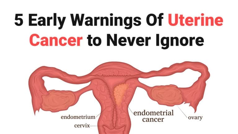 uterine cancer