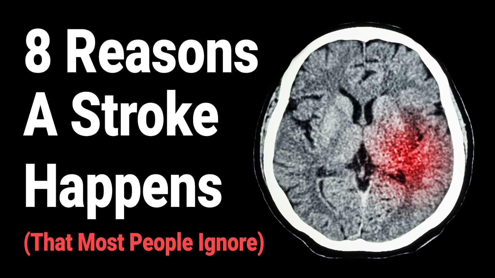 8 Reasons A Stroke Happens (That Most People Ignore)