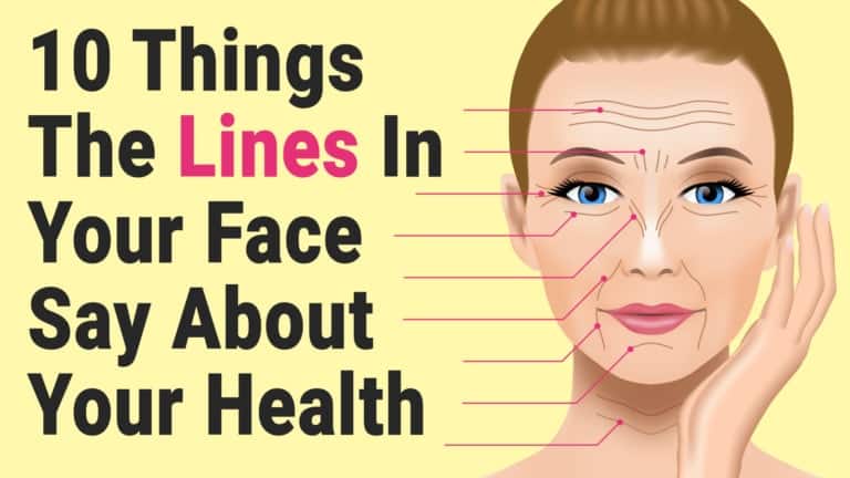 lines in your face