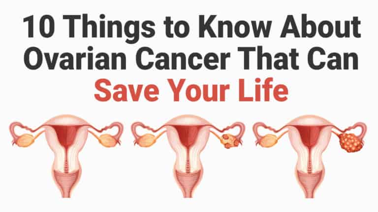 ovarian cancer