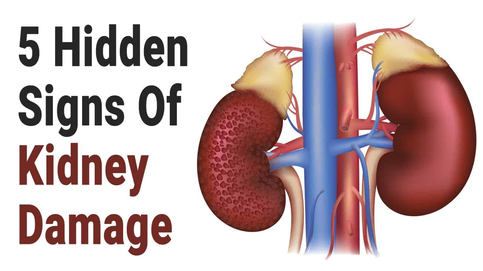 kidney damage