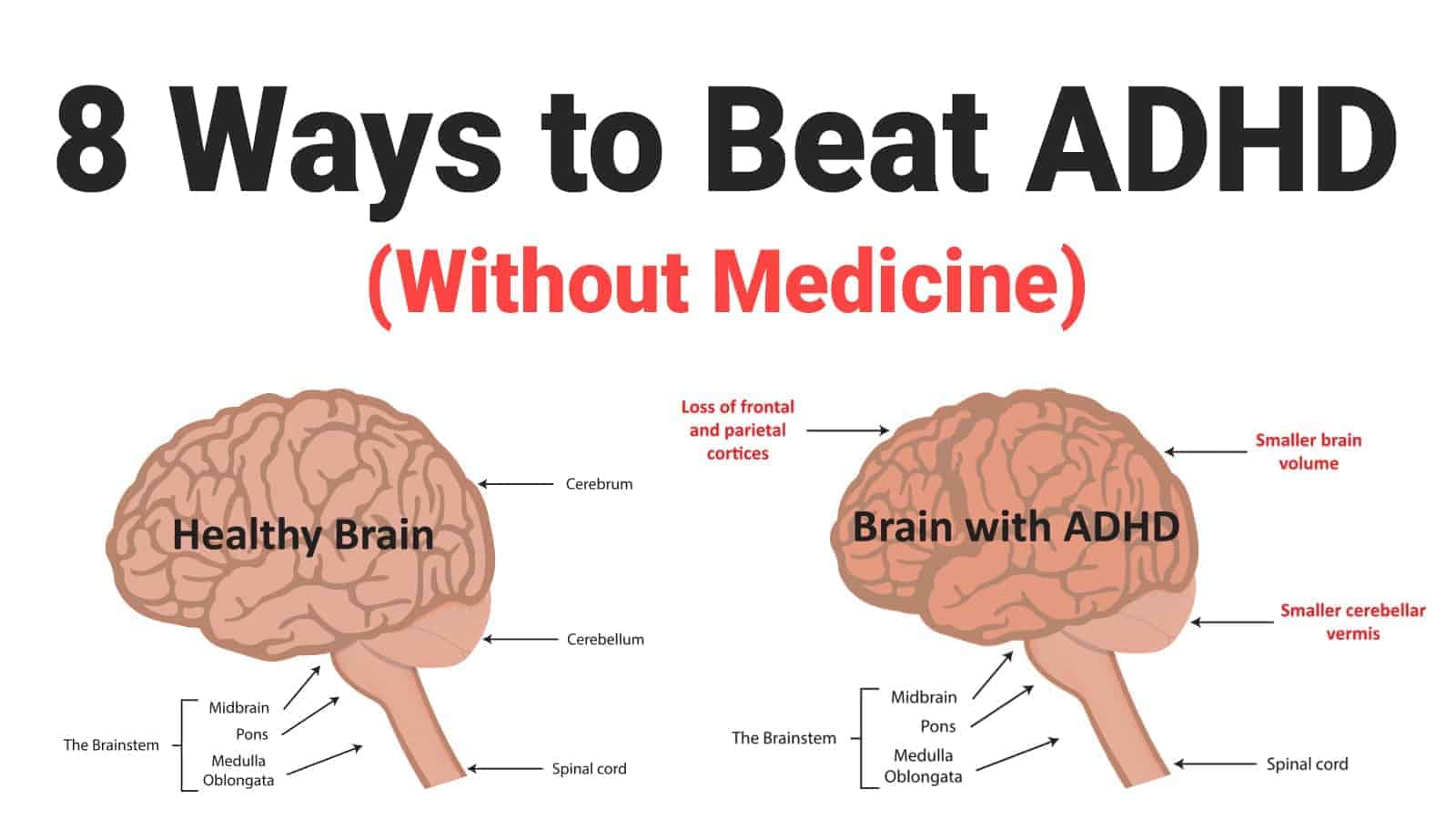 8 Ways to Beat ADHD (Without Medicine)