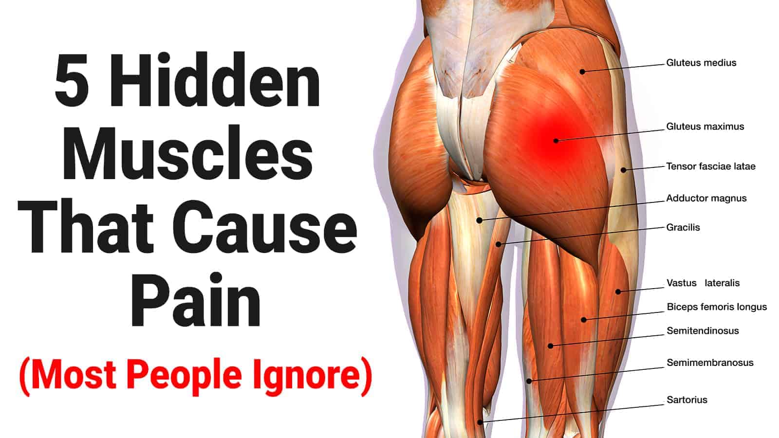 5 Hidden Muscles That Cause Pain (Most People Ignore)