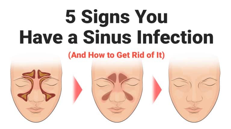 sinus-infection