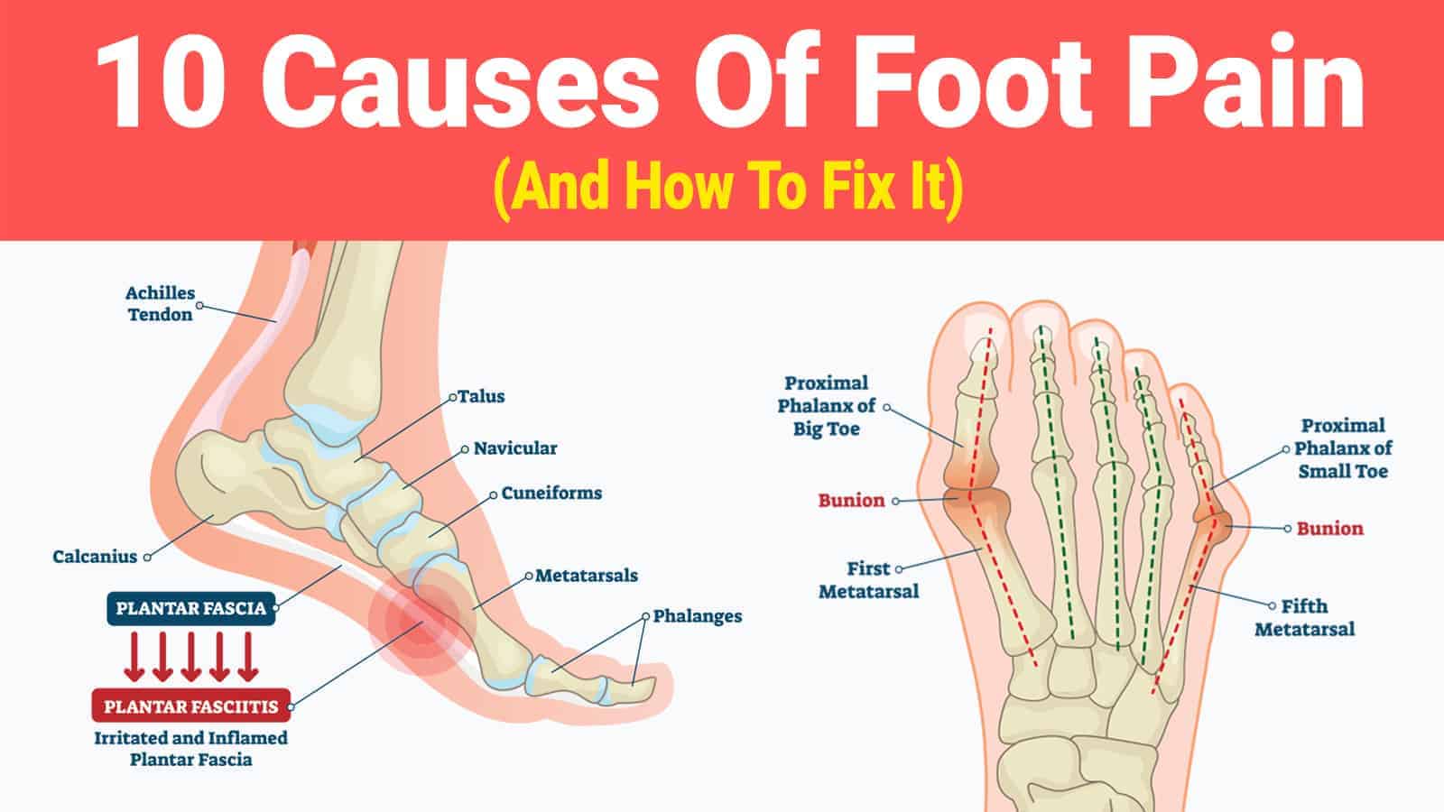 10 Causes Of Foot Pain (And How To Fix It)