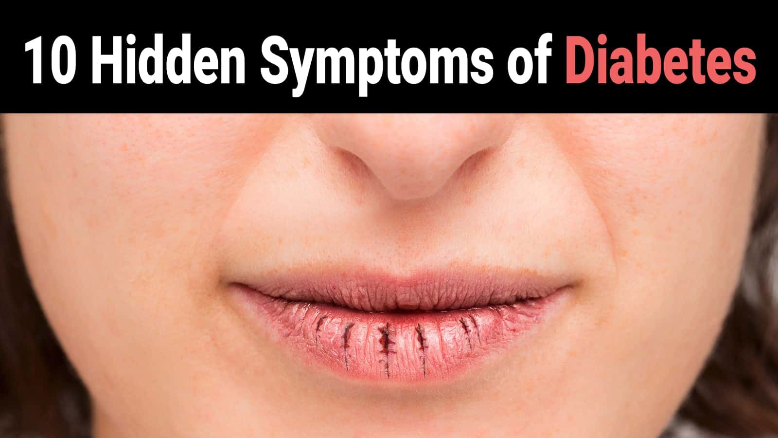10 Hidden Symptoms of Diabetes
