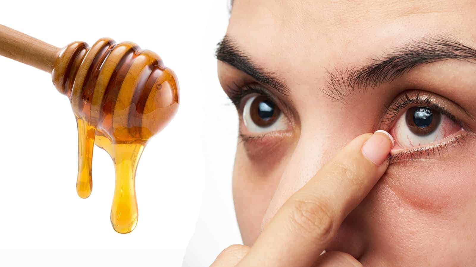 10 Ways to Relieve Eye Pain Naturally