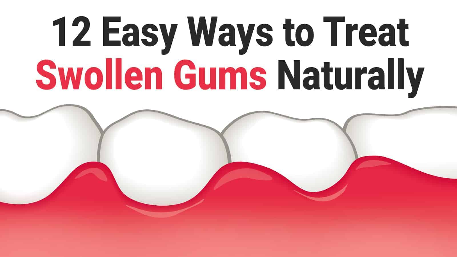12 Easy Ways to Treat Swollen Gums Naturally