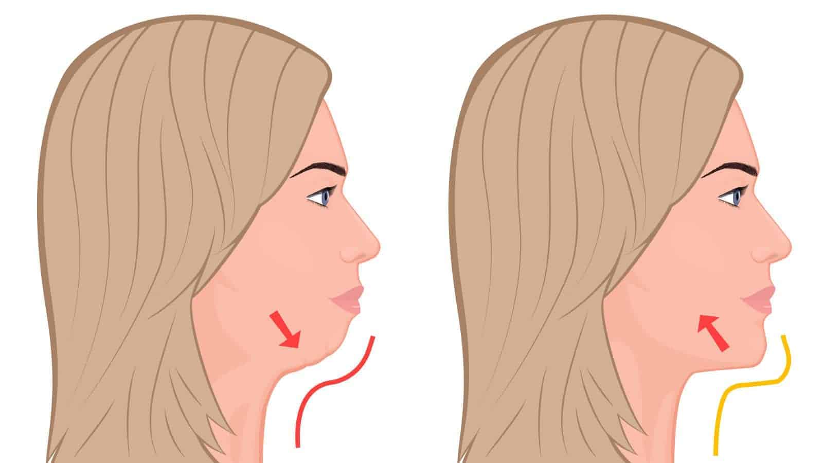 7 Exercises That Remove Double Chin