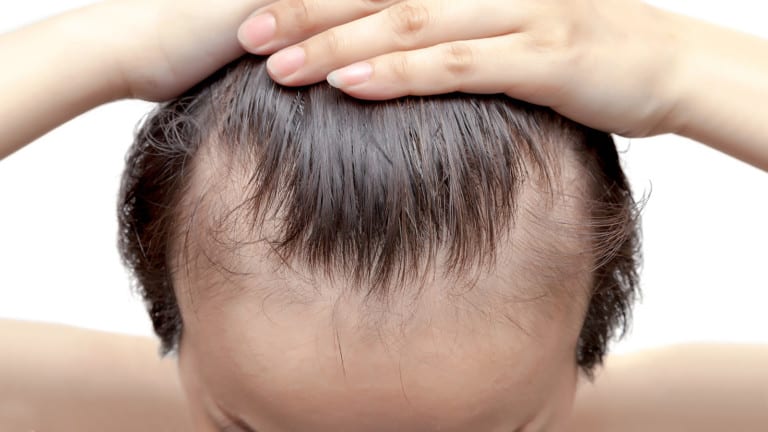 iodine deficiency