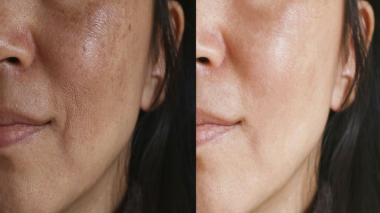 anti aging foods