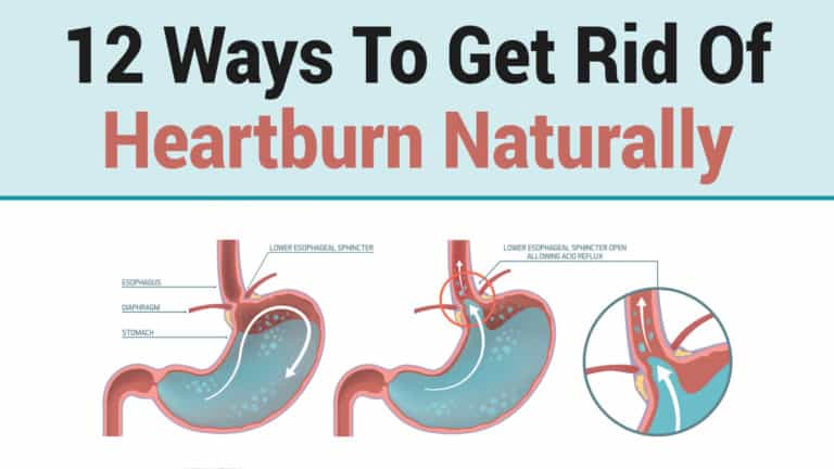 heartburn