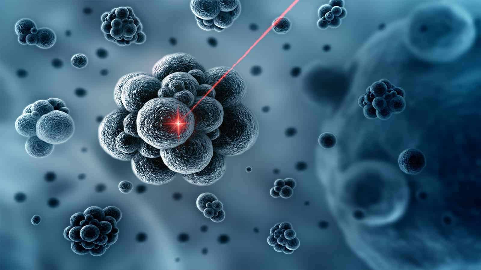 Physicist Reveals Technology That Kills Cancer With Lasers