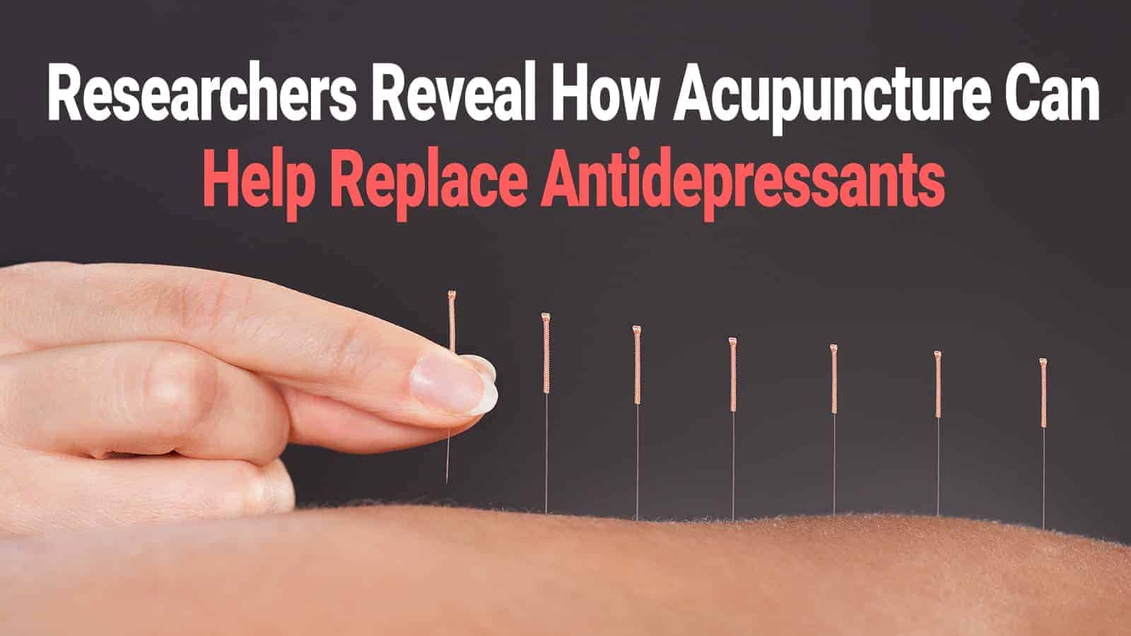 Researchers Reveal How Acupuncture Can Help Replace Antidepressants
