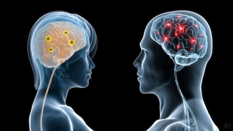 male and female brains