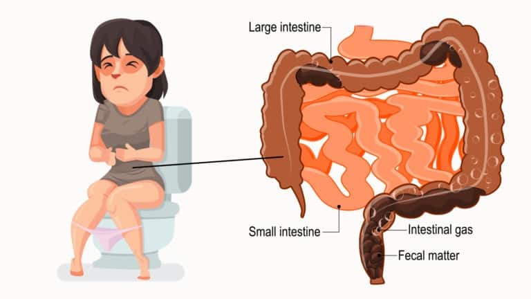 relieve constipation