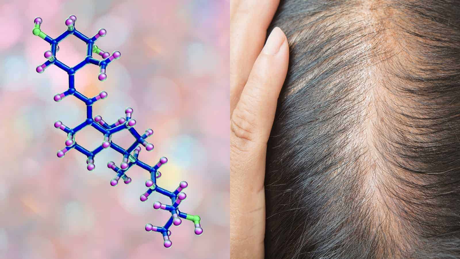 Researchers Reveal The Connection Between Vitamin D Deficiency And Hair Loss