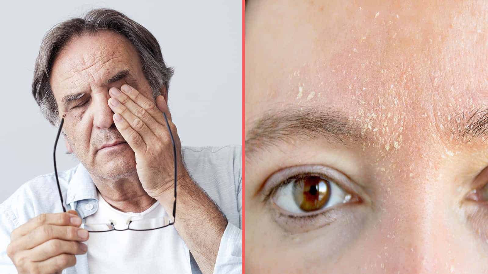 5 Hidden Signs You Are Vitamin Deficient