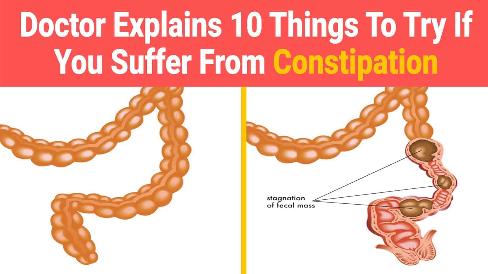 Doctor Explains 10 Things To Try If You Suffer From Constipation
