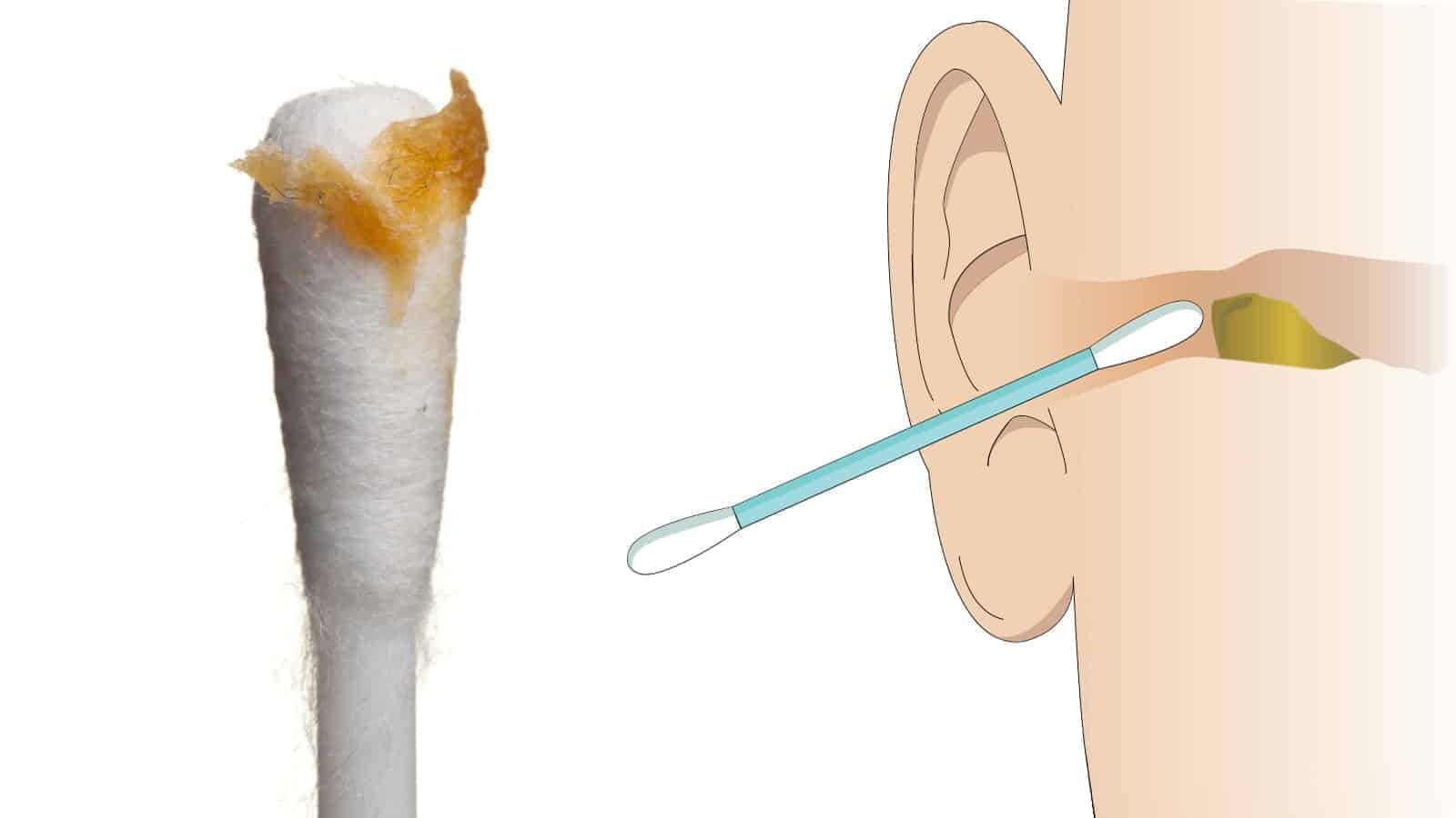 Ear Specialists Explain 6 Reasons to Stop Cleaning Ears With Cotton Buds
