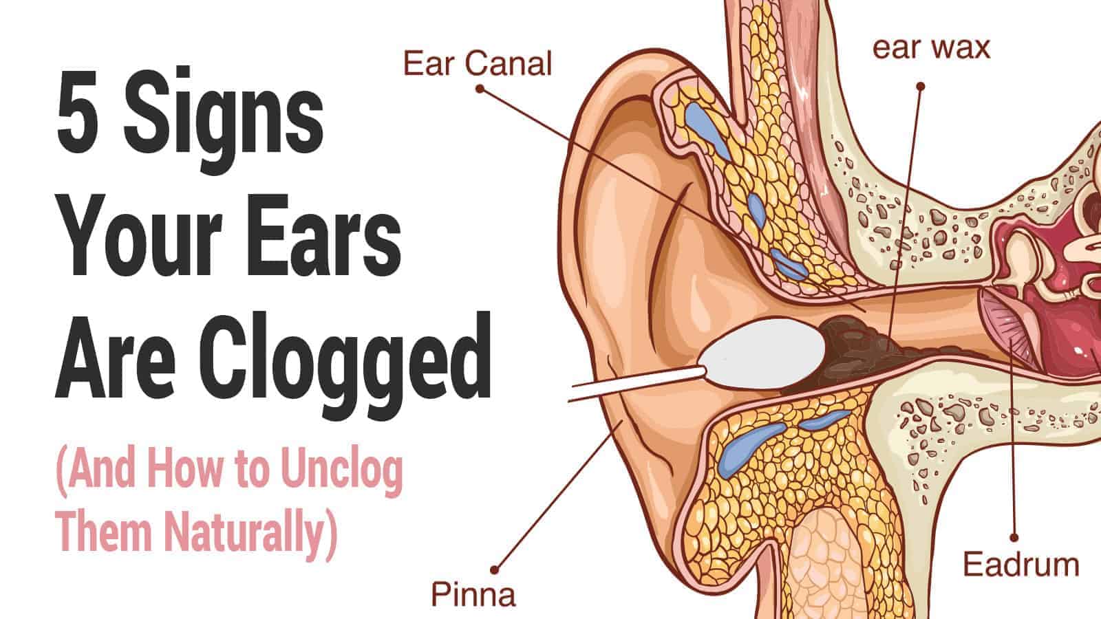 5 Signs Your Ears Are Clogged (And How to Unclog Them Naturally)