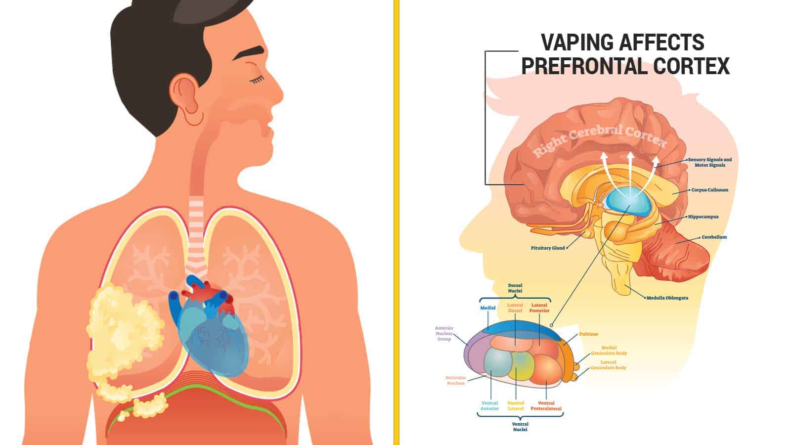 Researchers Reveal How Vaping Causes Brain and Lung Damage