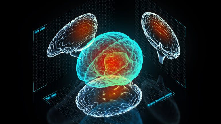 brain