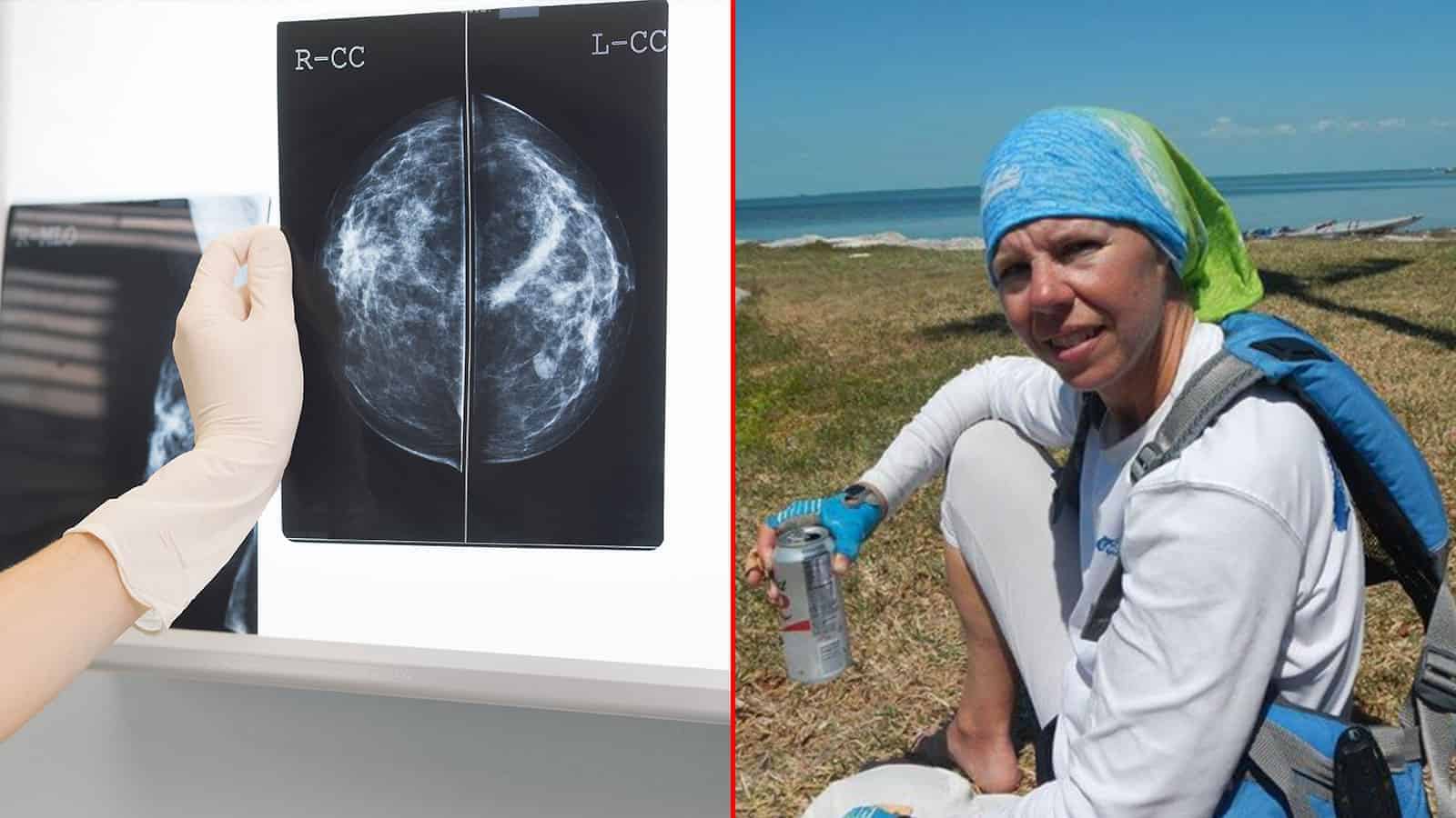 Here’s How A Woman Beat Stage 4 Breast Cancer in 2 Months Without Chemotherapy