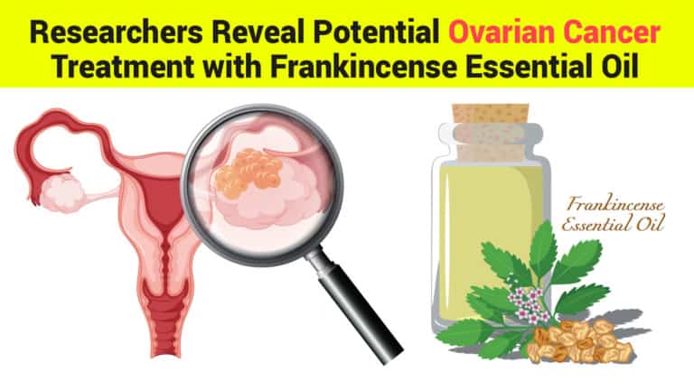 ovarian cancer treatment