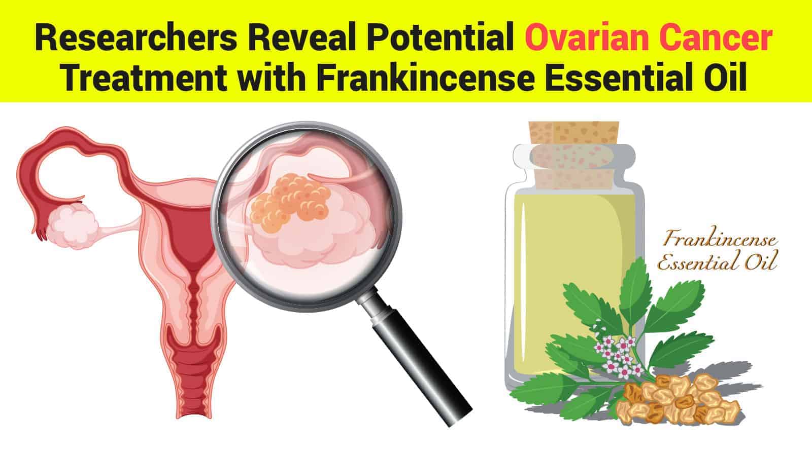Researchers Reveal Potential Ovarian Cancer Treatment with Frankincense Essential Oil
