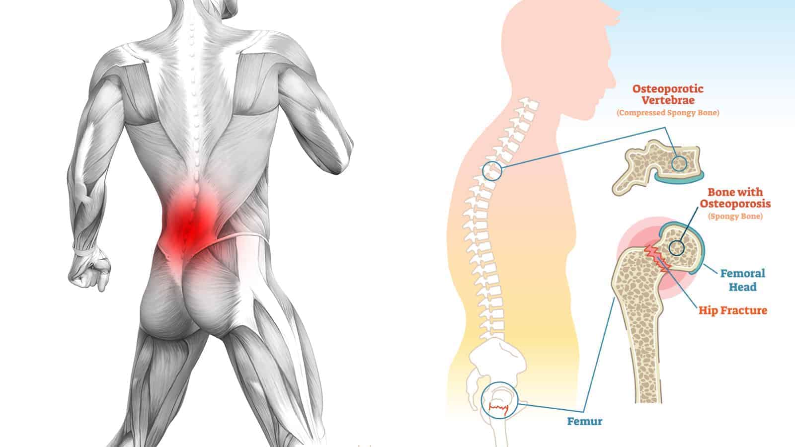 10 Reasons You Might be Dealing with Lower Back Pain and How to Fix it