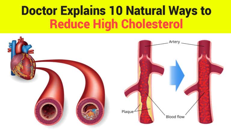 cholesterol
