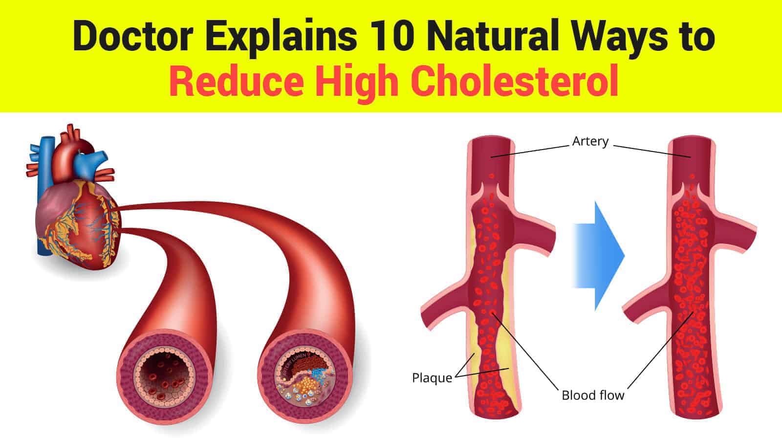 Doctor Explains 10 Natural Ways to Reduce High Cholesterol