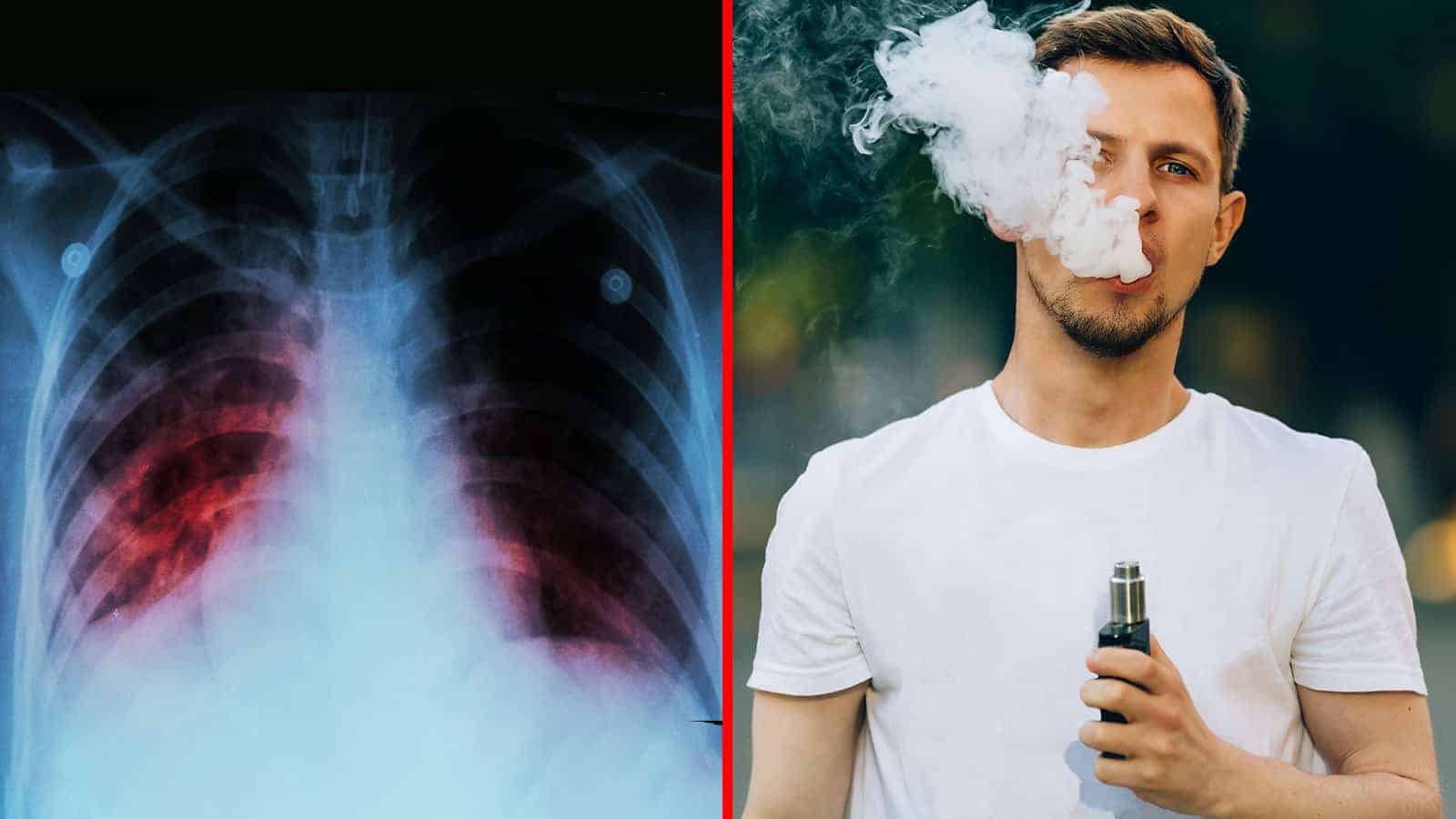 CDC Warns Against The Dangers of Vaping After Recent Spike in Lung-Related Illnesses