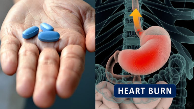 heartburn antacids