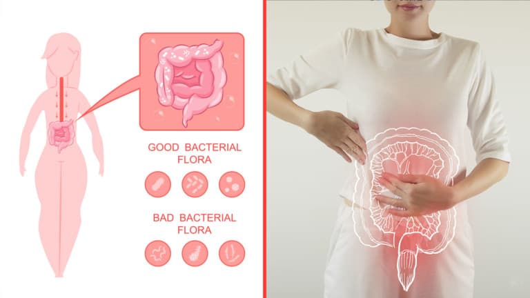 probiotics