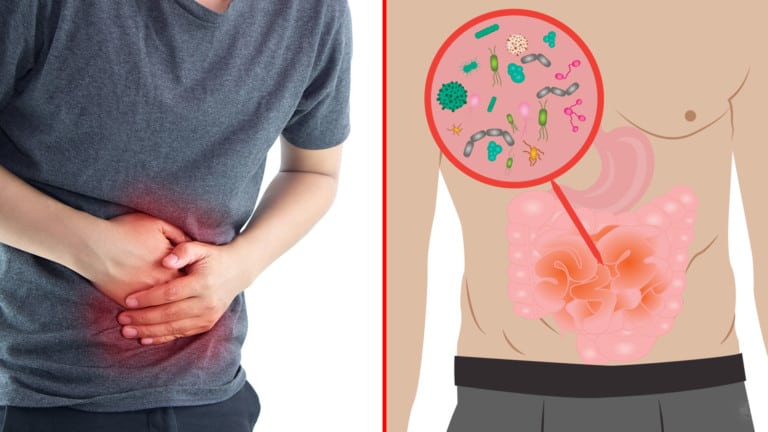 stomach