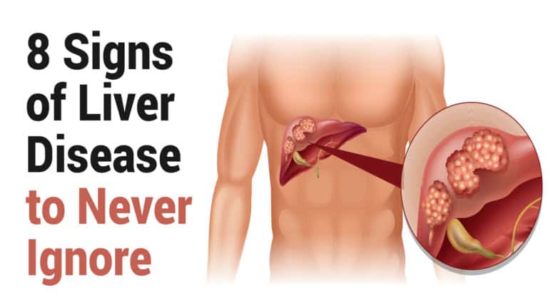 liver disease