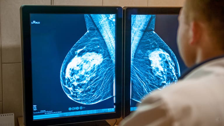 mammogram