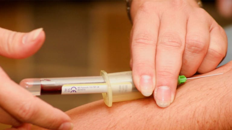 blood test for seizures